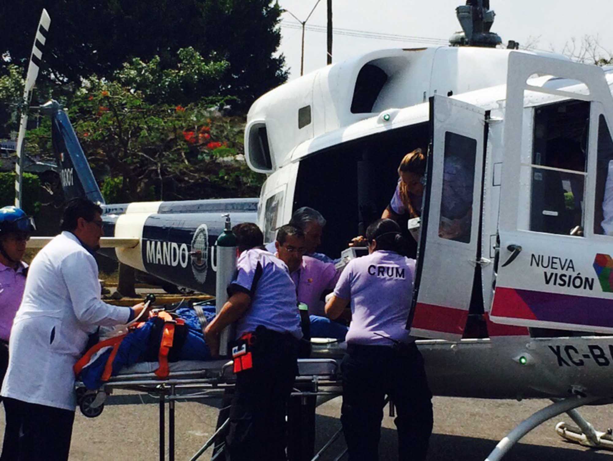 Compaesino con quemaduras